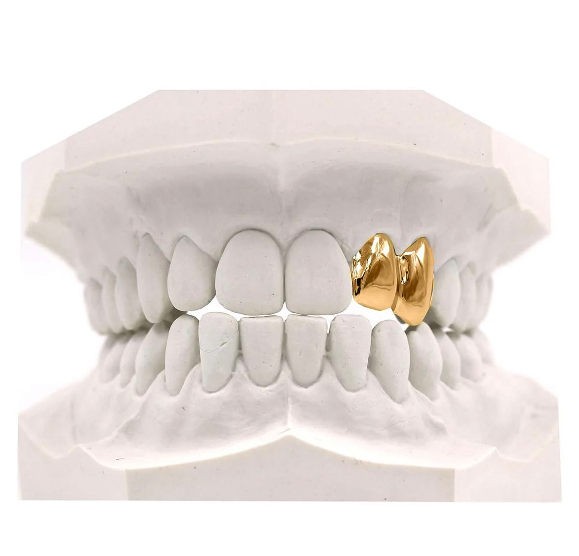 Scarabeaus DOUBLE CAP GRILLZ SOLID GOLD